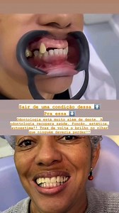 ORTHOLOG DEVOLVENDO SORRISOS! @orthologodontologia Nossa missão é fazer verdadeiramente a diferença na vida de cada paciente que passa por nossa clínica!! Aqui na ORTHOLOG, é isso que nos motiva todos os dias!! Agende sua avaliação: Whatsapp: 21 95903-3735 Rua Capitão Barbosa, 845- sala 204 - Cocotá Pagamento facilitado em todos os cartões, boletos e no super carnê! "Ortholog nossa missão é cuidar do seu sorriso😁" #ilhadogovernador #protese #sorriso #dentes #ortholog #alegriadeviver | Alerta IL