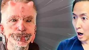 Extreme mods: Surgeon warns of the risks