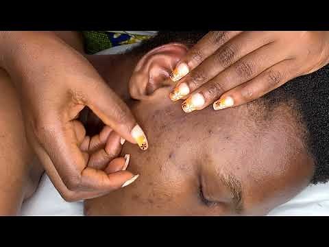 ASMR~ well zoomed face picking ( bubblegum sound)