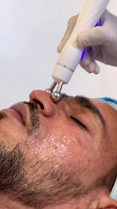 Hydra Dermabrasion Benefits: Deep cleansing pores Ultra sound penitration Radio frequency to stimulate collagen and elastic Dead skin removal LED mask Speacilised serum infusion Smooth silky skin By Dermal Clinician @dannisenanayaka @dermalabs_ Prices, services and to book an appointment Visit our website below 🅑🅞🅞🅚🅞🅝🅛🅘🅝🅔 www.salonzero.lk ——————————— Now Salon Zero is only a fingertip away 🅲🅻🅸🅲🅺 🅻🅸🅽🅺 🅱🅴🅻🅾🆆 👇👇👇👇 https://www.fresha.com/.../salon-zero-pvt-ltd-nugegoda...