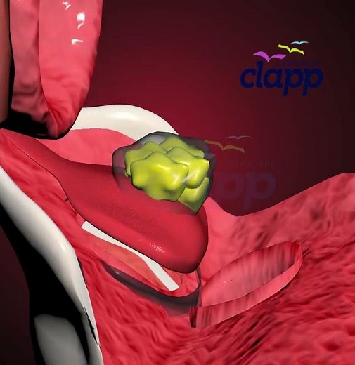 Epiglottis the gate keeper of trachea (3D Animation)