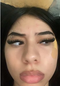 Why My Dog Bit My Face — What to Do After a Dog Bite