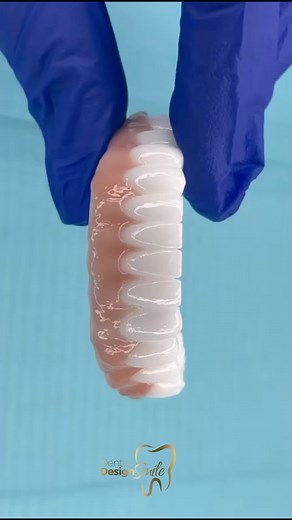 5.6K views | Smile with confidence! Regain your perfect smile with our incredible solution: Total Denture over Implants. Now, not only will you be able to enjoy your favorite foods without worries, but you will also showcase a radiant and natural smile. 﫶 | Dental Design Smile | Facebook