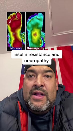 How to avoid neuropathy and the early signs | Reversing insulin resistance