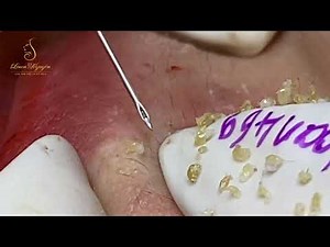 Satisfying With Loan Nguyen Spa Video #026