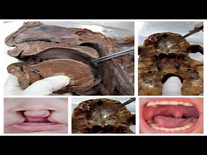 Anatomy Dissection of Hard and Soft Palate