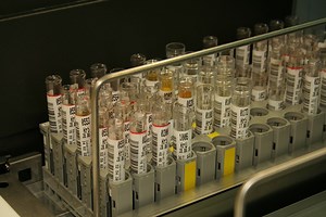 Human Urine as Fertilizer? | Videos