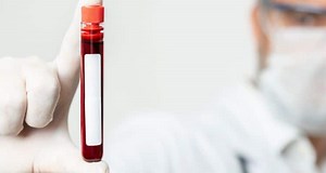 Ultraviolet Blood Irradiation | Benefits & Immune Support Therapy