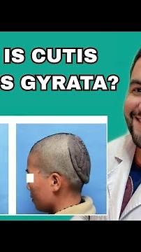 What Is Cutis Verticis Gyrata? Explained by Dr. David Campos