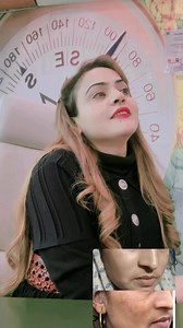 5.6K views · 52 reactions | Skin care - 8826294776 #Skincare #HealthySkin #BeautyRoutine #SkinCareEssentials #HydratedSkin #SkincareAddict #FaceCare #SelfCare | Nisha Lambha - Sparsh Beauty Care & Hair Treatment LLP | Facebook