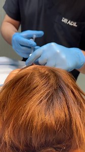 Liquid Rhinoplasty Done By Dr Adil Hamayun For further details contact us  0317-0597000 0304-0957000 | De Looks Clinic Skin Hair Body Aesthetics & Hair Transplant | Facebook