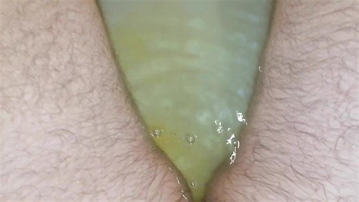 Diarrhea explosion in bathtub bath water