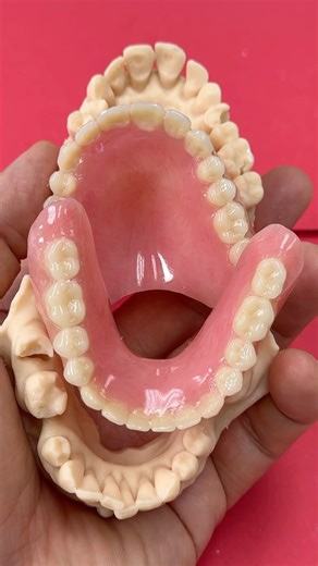 Immediate denture!.. case from Dr,Paul Connolly in New Hampshire | CEO Luke Kahng