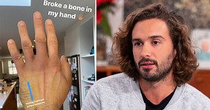 Joe Wicks breaks a bone in his hand after falling off his bike