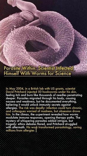 💉 Parasite Within: Scientist Infected Himself With Worms for Science 🪱😱