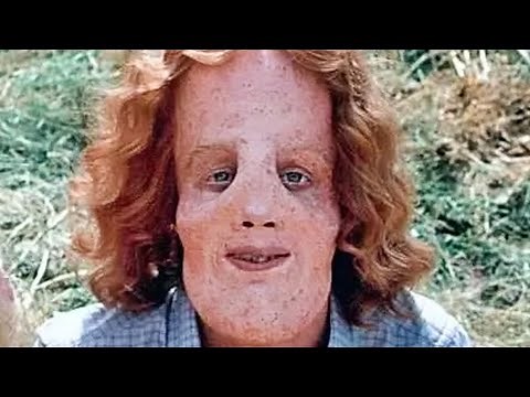 Mask - Heartbreaking Tragedy Of Rocky Dennis From "Mask"