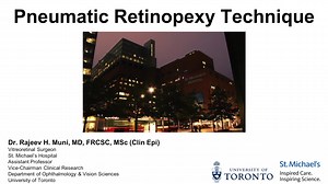 Pneumatic Retinopexy for Rhegmatogenous Retinal Detachment - Eyetube