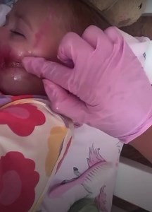 Re sharing this post sent in my Tillies mum. @tilliemaifox has been through so much. This beautiful baby was sadly attacked by a dog. Such an awful thing for this family to go through. Here, the Green Cream is being used to gently help while she’s been healing💛 | Zoe Bee Beauty