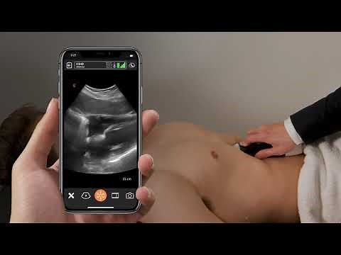 Extended FAST Exam with Dr. Daniel Kim