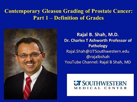A Dummies Guide to Contemporary Gleason grading of Prostate Cancer-Definition Of Grades