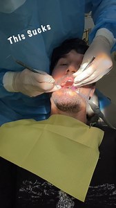 This sucks... A failed root canal in Uganda led to me getting my tooth extracted... It's all a part of the journey... On Vacation Doctor | 2Up and Overloaded