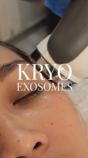 Kryo Exosomes utilizes cryoinfusion and cryoelectrophoresis technologies to enhance skin absorption of exosomes, ensuring rapid and visible skin transformation. These methods effectively tighten loose skin, smooth fine lines, and clear blemishes, while exosomes promote cellular repair and regeneration. For ultimate anti-aging results, combining Glycolic Acid Cleansing with Kryo Exosomes comes highly recommended by our doctors! #bestfacialinmanila #aeshteticscience #exosomesph #facialph #dermaph 