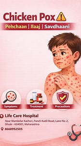 Chicken pox ka chicken se koi lena-dena nahi ❌🍗 Sach jaano, myths todo. #awareness #doctorlife #chikenpox #doctor #dhulekar | Aamir Shaikh