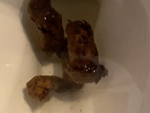 Dark Logs After Hissy Fart