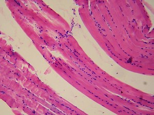 Smooth muscle tissue - Alchetron, The Free Social Encyclopedia