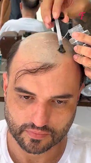 9.4K views · 68 reactions | Barber's Enchantment: The Art of Men's Hair Transformation✂️ Witness the mesmerizing transformation as this barber works his magic to create stunning hairstyles for men. Prepare for a remarkable style upgrade! #BarberMagic #StyleRevamp #NewLook | Fabiosa Hearty | Facebook