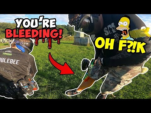 PAINTBALL FUNNY MOMENTS & FAILS ► INJURIES IN PAINTBALL 😱