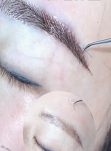 941K views · 7K reactions | eyebrow transplant | Eye Show | Facebook