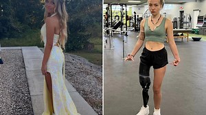 My leg was torn off by 10ft shark - I gouged its eyes but it wouldn’t let go