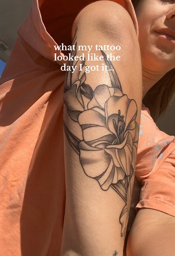 Tattoo Removal Journey: Before and After Transformation