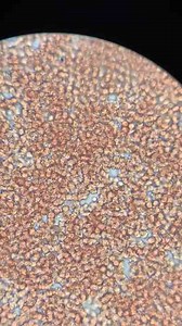 What Blood Looks Like Under the Microscope