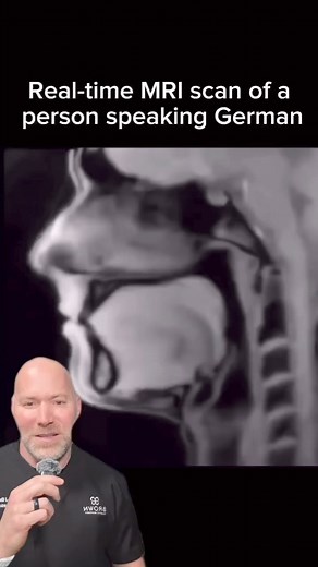 35K views · 903 reactions | Pretty cool #anatomy | Ricky Brown | Facebook