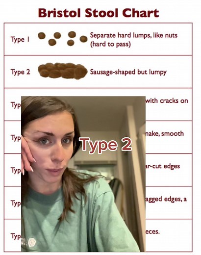 Please look at your poop 💩 The Bristol Stool Chart: 💩 Type 1: Separate hard lumps, like nuts (difficult to pass): This type indicates constipation. The stool has spent a long time in the colon, and water has been absorbed, making it hard and difficult to pass. 💩 Type 2: Sausage-shaped, but lumpy: This stool is also a sign of constipation, though less severe than Type 1. It suggests that the stool spent some time in the colon and has become somewhat compacted. 💩 Type 3: Like a sausage but wit