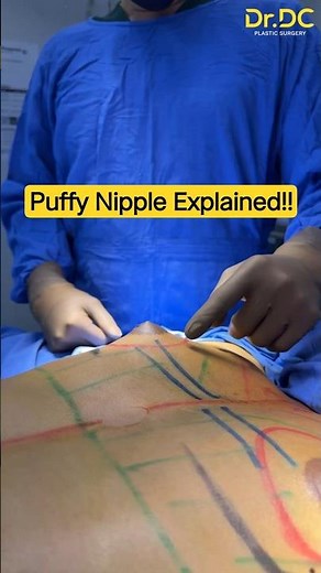 Why Puffy Nipples Appear Flat After Bath or Cold Weather? | Dr DC, Plastic Surgeon Pune, India.