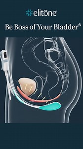 334K views · 61 shares | Treat Your Bladder Leaks with Elitone | Elitone by Elidah | Facebook