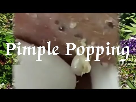 Pimple & Blackheads Popping - 24