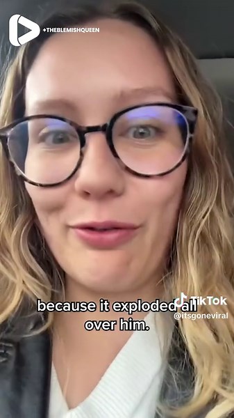 Satisfying Pimple Popping Videos Explained