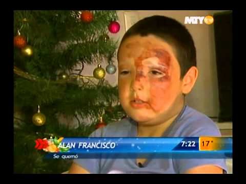 Las Noticias - Se quema niño con cohete, cuenta su historia