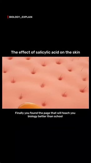 medical / biology explain on Instagram: "penetrates deep into pores, dissolving excess oil and dead skin cells that cause acne. A perfect example of how chemistry meets biology to keep your skin healthy! 💧🔬" DM for credit l removal.... For educational purposes only... Follow: @biology_explain #SalicylicAcid #SkinScience #AcneTreatment #BiologyExplain #DermatologyFacts #SkinCareScience #ChemicalExfoliation #ClearSkinJourney #ScienceOfBeauty #BiologyInEverydayLife"