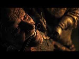 Game of Thrones S7E2 - Sam treats Jorah Mormont