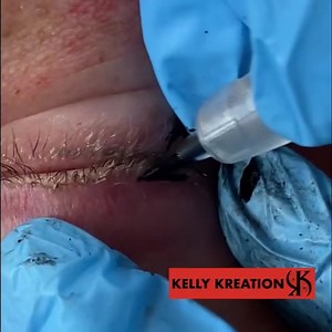 A closer look at the permanent eyeliner application! This procedure...