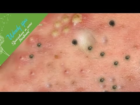 Make Your Day Relaxing with Windy Spa