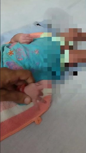 ERB'S PALSY BABY TREATMENT-EXERCISES TO ATTAIN NORMAL ARM FUNCTION #physiotherapist #physiotherapy