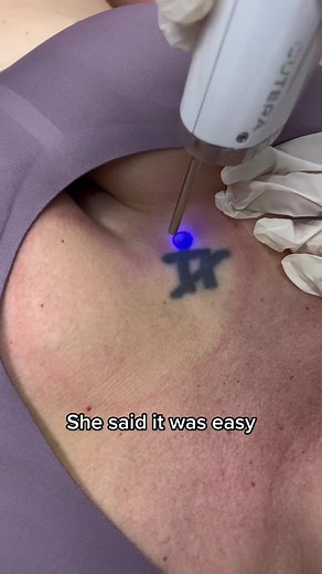 The INK ERASER on TikTok