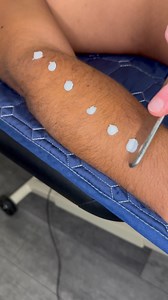 🏆 Instrument Assisted Soft Tissue Mobilization (IASTM) helps break up scar tissue and fascial restrictions using specially designed tools. This technique promotes better circulation, restores mobility, and speeds up recovery from overuse or injury. #IASTM #SoftTissueTherapy #ChicagoChiropractic #chiropractor #drkyleross | Dr_kyleross