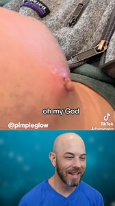 You've GOT to see this super infected cyst removal🫣 (credit: @pimpleglow on TT) #cyst #s#satisfying #doctor | Dr. Dustin Portela, Dermatologist